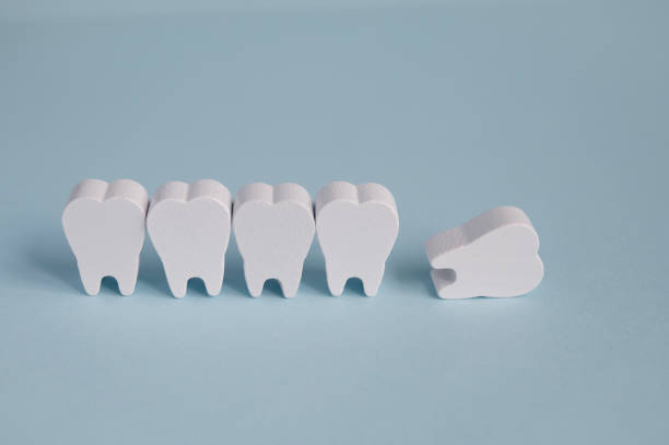 Toy wooden teeth on a blue background. Fallout, tooth loss medical concept. stock photo