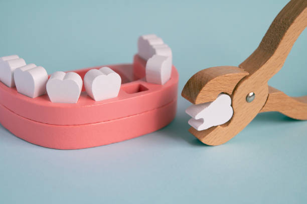 Toy wooden teeth on a turquoise background. Fall out, tooth loss medical concept. stock photo