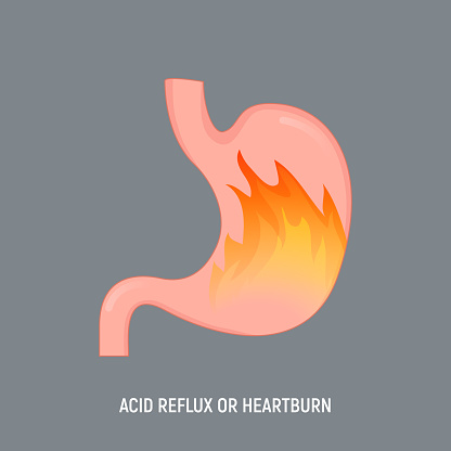 Acid stomach burn gastritis icon. GERD acidity stomach reflux heartburn ache.