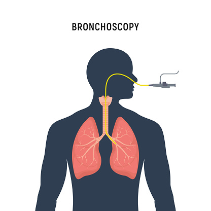 Bronchoscopy respiratory system emphysema endoscopy human lung examination. Bronchoscopy icon.