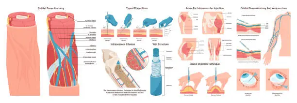 Vector illustration of Injection sites set. Medicine injection sites on the human body.