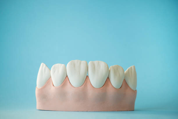 istock Jaw and teeth made of plaster. layout on a blue background. 2030258869