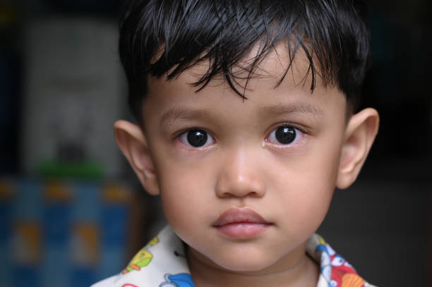 portrait d’un enfant atteint d’une maladie oculaire - conjunctivitis sore eyes child human eye photos et images de collection