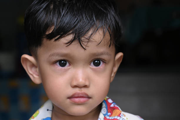 안과 질환을 앓고 있는 아이의 초상화 - conjunctivitis sore eyes child human eye 뉴스 사진 이미지
