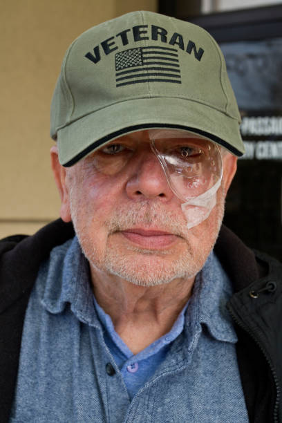 istock Senior American veteran right after cataract surgery 2032993341