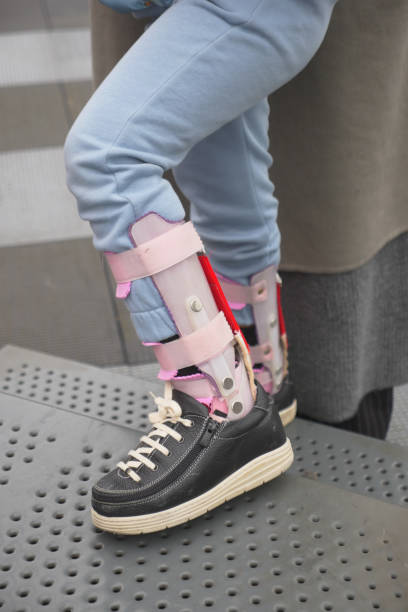 istock Child cerebral palsy disability, legs orthosis. 2033413484