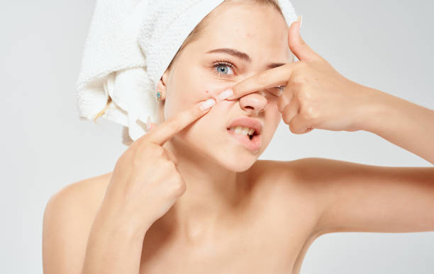istock Woman and squeezes pimples on her face problem skin with a towel on her head bare shoulders 2034878102