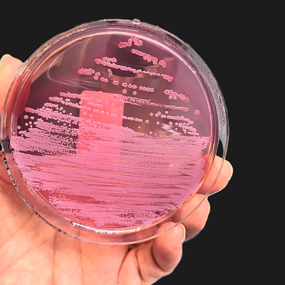 Salmonella bacterium found to be sensitive to all antibiotics tested for.