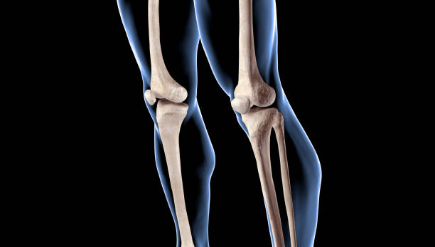 인간 남성의 신체 다리 부위의 의료 일러스트레이션 - orthopedic equipment osteoporosis x ray human spine 뉴스 사진 이미지