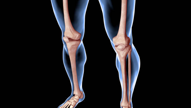 인간 남성 다리의 의학 삽화 - orthopedic equipment osteoporosis x ray human spine 뉴스 사진 이미지