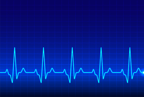 ECG heartbeat monitor, cardiogram heart pulse line wave. Electrocardiogram medical background.