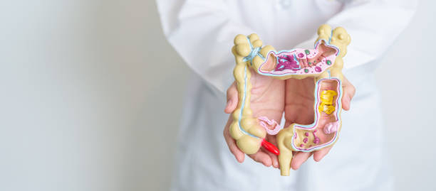 doctor holding human colon anatomy model. colonic disease, large intestine, colorectal cancer, ulcerative colitis, diverticulitis, irritable bowel syndrome, digestive system and health concept - descending colon стоковые фото и изображения