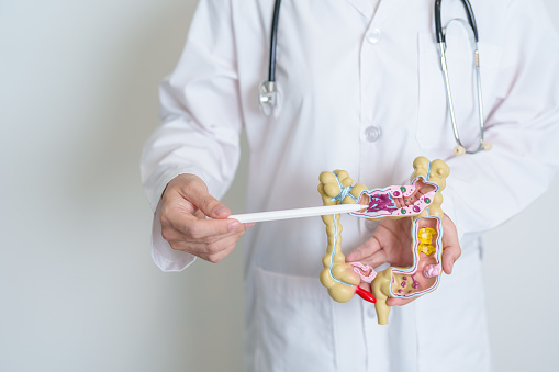 Doctor holding human Colon anatomy model. Colonic disease, Large Intestine, Colorectal cancer, Ulcerative colitis, Diverticulitis, Irritable bowel syndrome, Digestive system and Health concept