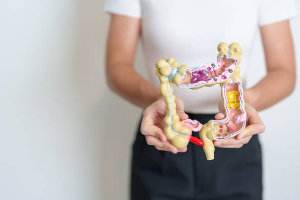 woman holding human colon anatomy model. colonic disease, large intestine, colorectal cancer, ulcerative colitis, diverticulitis, irritable bowel syndrome, digestive system and health concept - descending colon ストックフォトと画像