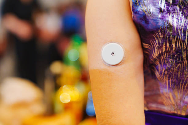 istock Sugar monitoring sensor on the shoulder. An insulin pump. 2042177480