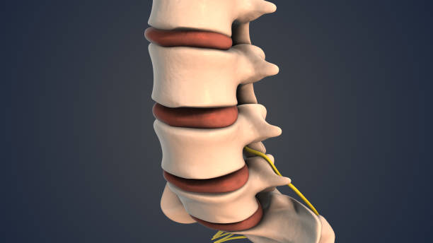 istock Herniated disc of the lumbar spine 2043026406