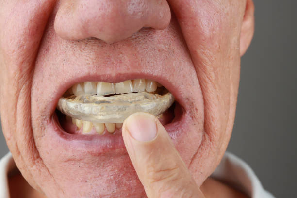 istock Man with his night mouth guard that he wear at night 2043649580