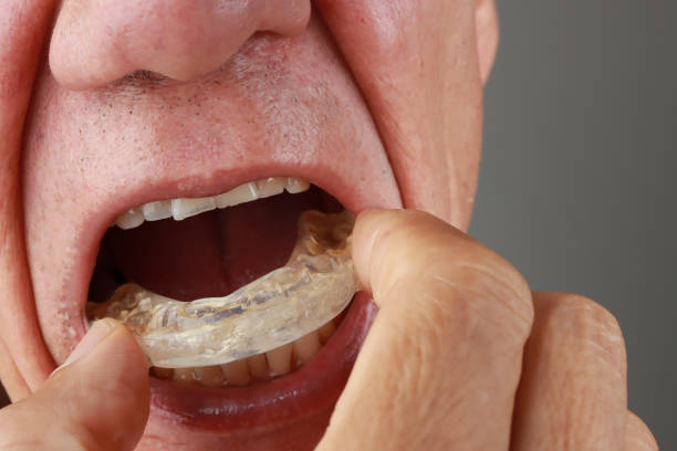 istock Man with his night mouth guard that he wear at night 2043649666