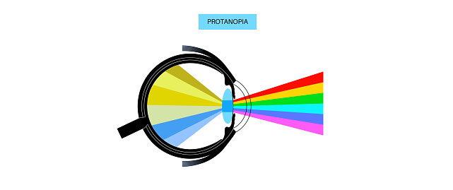 Deuteranopia vision eye abnormality, color blindness infographic. Human vision deficiency concept. Difference between colors, brightness and intensity of shades flat vector illustration