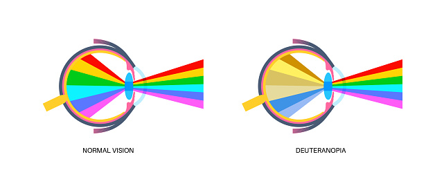 Deuteranopia and normal vision, color blindness infographic. Human vision deficiency concept. Difference between colors, brightness and intensity of shades flat vector illustration