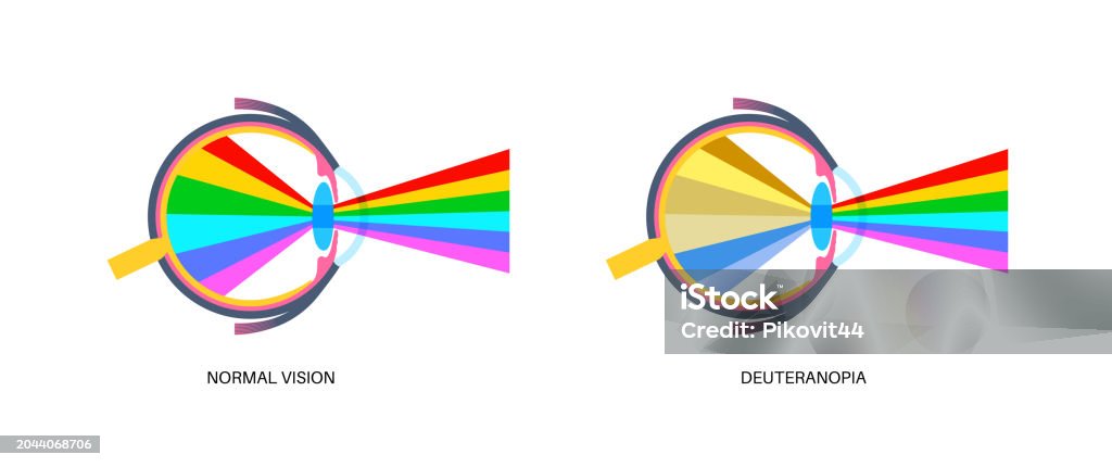 Deuteranomaly And Deuteranopia Stock Illustration - Download Image Now ...