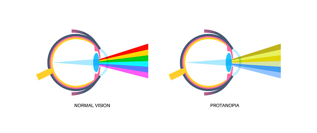 Protanopia vision, color blindness infographic. Human vision deficiency concept. Difference between colors, brightness and intensity of shades. Eye abnormality flat vector illustration