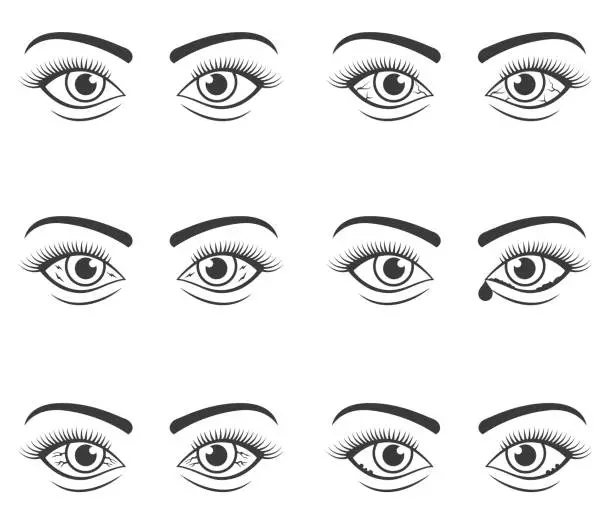 Vector illustration of Eye pain icon set