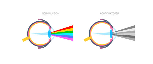 Chromitopia 40+ Achromatopsia Stock Photos, Pictures & Royalty-Free Images - iStock