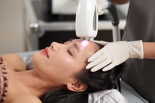 Closeup image of young woman getting forehead hair removed with laser