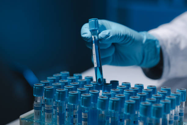 istock Many test tubes were analyzed by experts, A researcher is carefully studying the liquid contained in a test tube because it is an important area of research. 2046769944