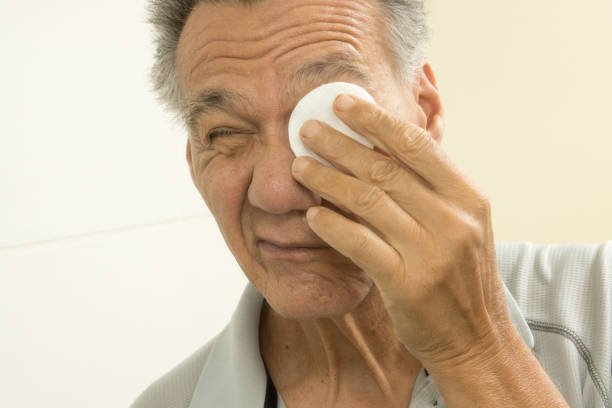Man applying cotton eye pads to his eyes for dry eye relief