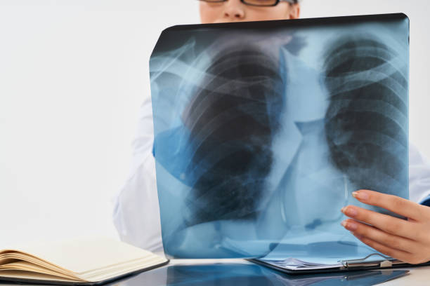 istock radiologist x-rays for professionals health diagnostics 2051775595