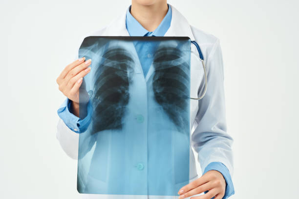 istock doctor in a white coat x-rays of the lungs research work 2052459997