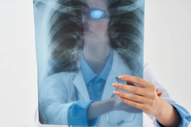 istock doctor with x-ray lung diagnostics clinic treatment 2052470535