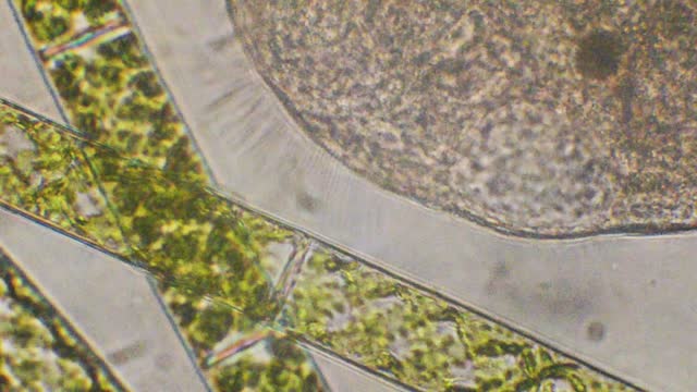 ciliate with cilia
