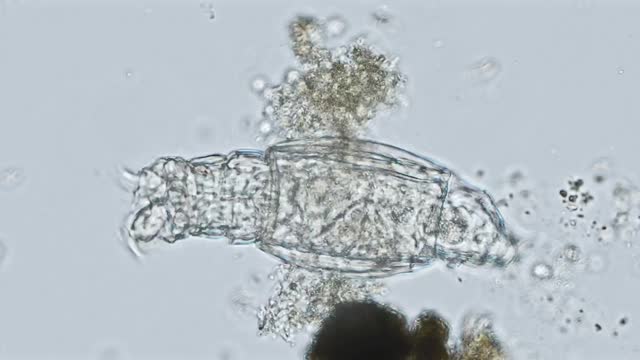 rotifera of the family Habrotrochidae under the microscope - light microscope x400 magnification