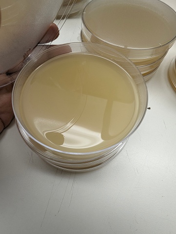 Baird Parker agar plates with egg telluride which are used to identify Staphylococcus aureus and other microbial species.