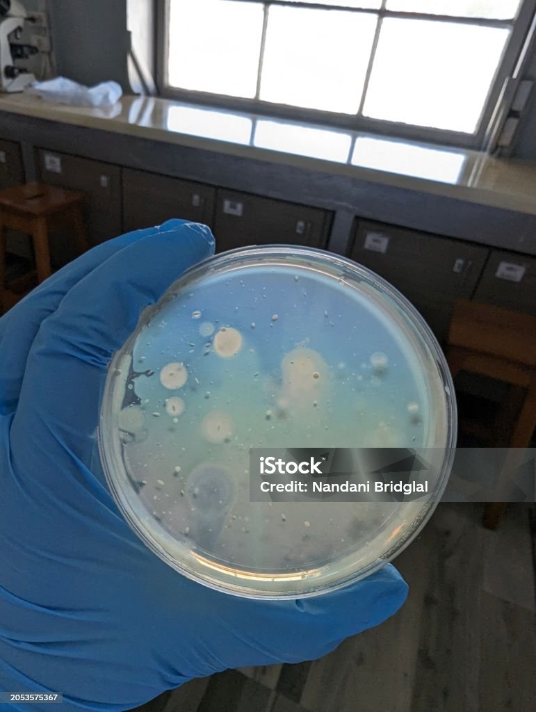 Bacteria Colonies On Plate Count Agar Stock Photo - Download Image Now ...