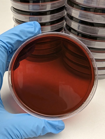 An eosin methylene blue agar plate in a microbiology laboratory being held by a scientist or microbiologist.