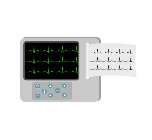 Vector illustration of The Electrocardiogram or Electrocardiography (ECG or EKG) Machine for detecting electrical signals in the heart that refer to beat in normally and abnormally conditions.