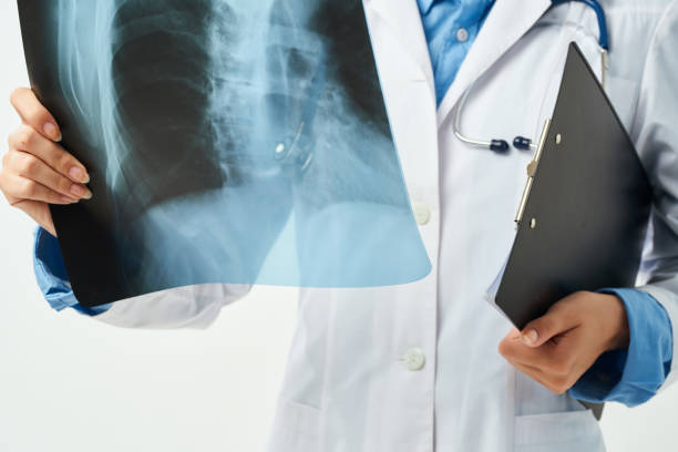 istock radiologist in a white coat x-ray close-up 2055929240