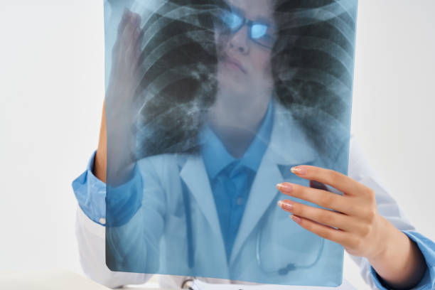 istock doctor with x-ray lung diagnostics clinic treatment 2055957618