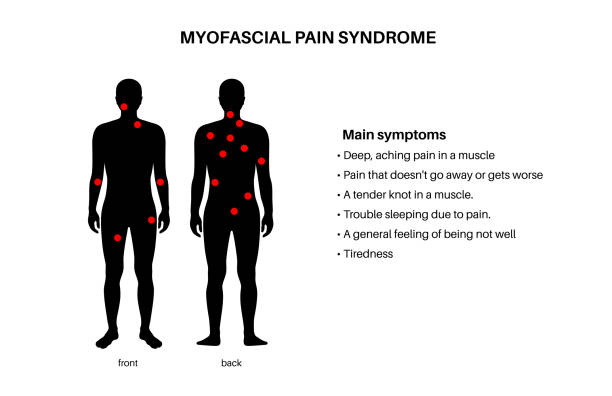Myofascial trigger points Myofascial trigger points medical poster. MTrPs concept. Hyperirritable spots in the skeletal muscle knots in male silhouette. Red points in sensitive areas on the human body flat vector illustration pain points stock illustrations