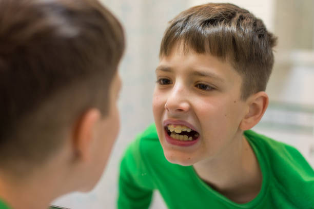 Boy observing dental braces in the mirror