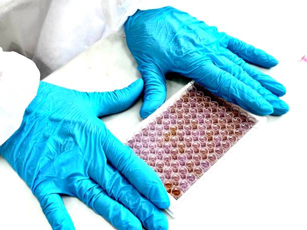 Enzyme-linked immunosorbent assay (ELISA) plate, Immunology testing method in laboratory Immunology or serology testing method in science medical laboratory Apoptosis Assays stock pictures, royalty-free photos & images