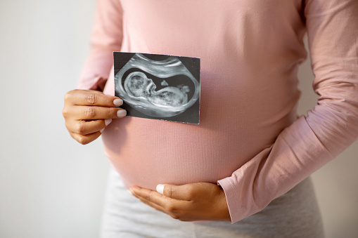 Unrecognizable black pregnant lady demonstrating her baby sonography photo, young expectant mother showing first photo of her child, enjoying happy maternity time, cropped image, closeup