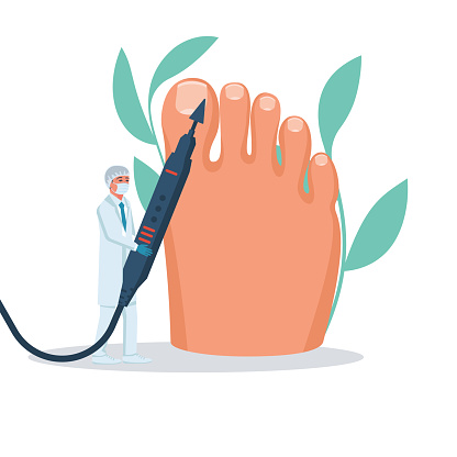 Podiatry concept. Feet treatment. Hardware medical pedicure. Nail cleaning apparatus. Patient on pedicure with pediatrician chiropodist. Clinic podology. Cosmetics of nails of legs. Vector design flat