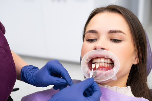 The dentist meticulously chooses the enamel shade for the teeth of the young brunette woman before whitening procedure.