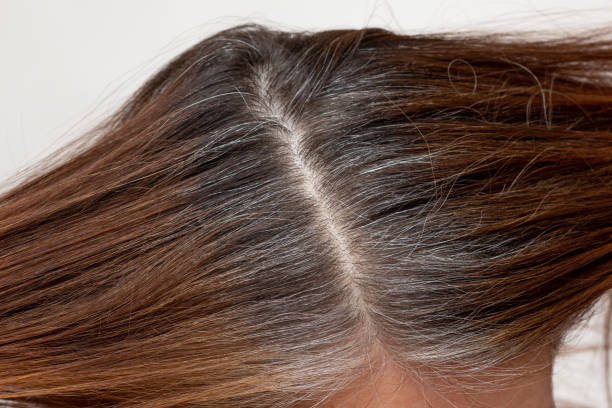 istock Top view of regrowth root with grey hair 2061908727