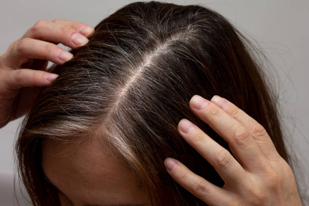 istock Top view of hands on regrowth root with grey hair 2061908728